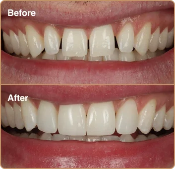 dental-treatment-before-after-img-6