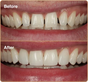 before-after-1