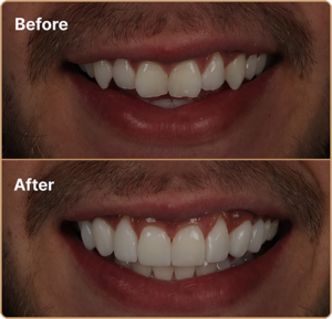 Smile Gallery | Ruh Dental