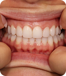 teeth-image