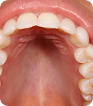 teeth-image