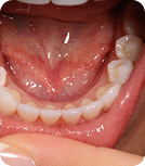 teeth-image
