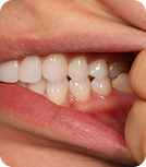 teeth-image