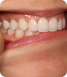 teeth-image