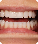 teeth-image